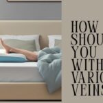 varicose veins